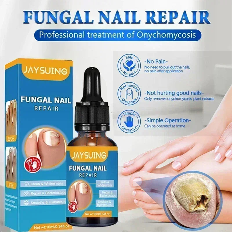Electric Toenail Fungus Treatment Device Nail Care