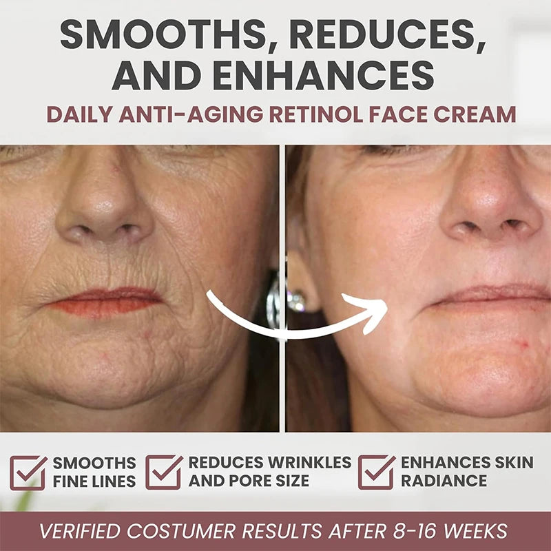 JANYIF Retinol Cream for Wrinkle Reduction and Firming