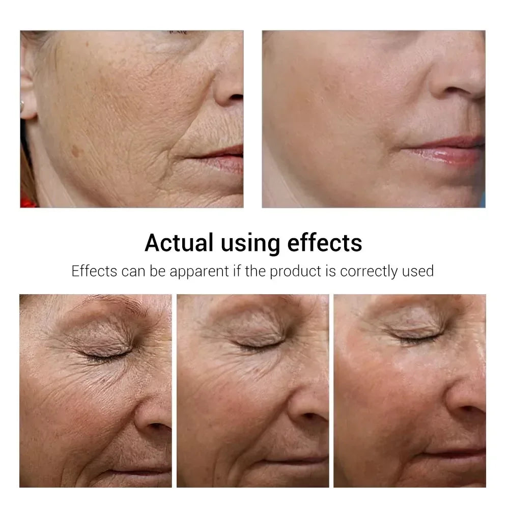 Eelhoe Retinol Wrinkle Remover Face Cream Anti Aging