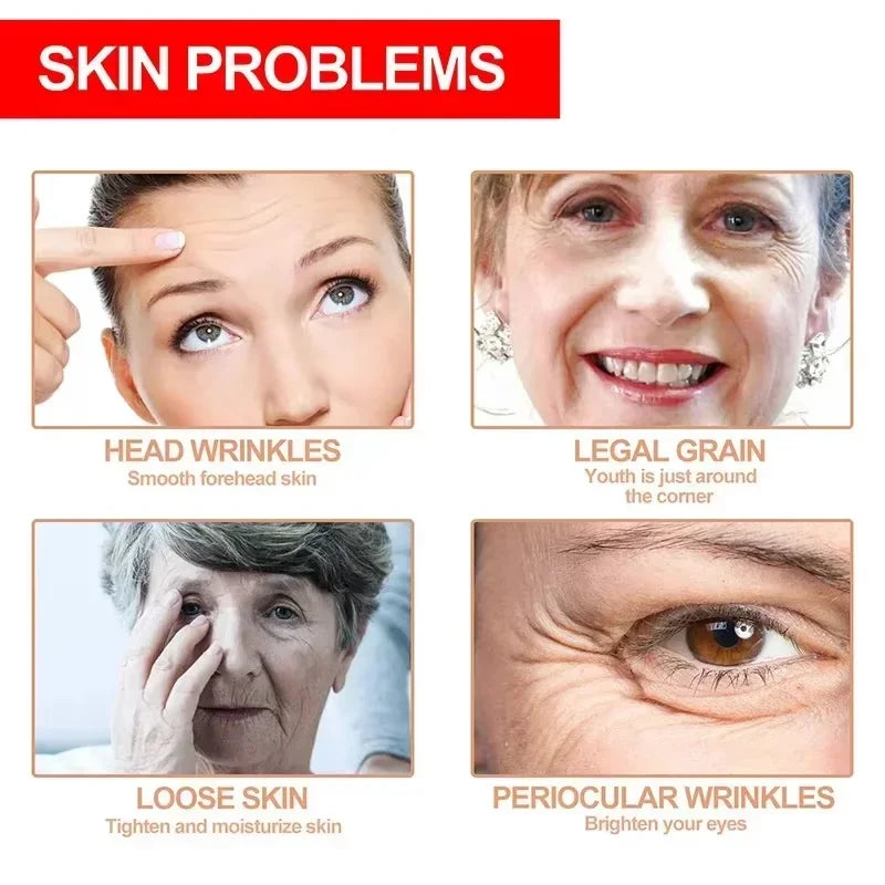Eelhoe Retinol Wrinkle Remover Face Cream Anti Aging