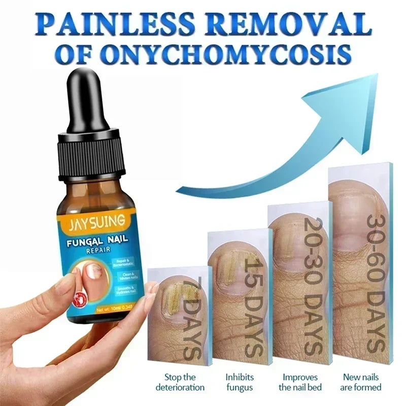 Electric Toenail Fungus Treatment Device Nail Care