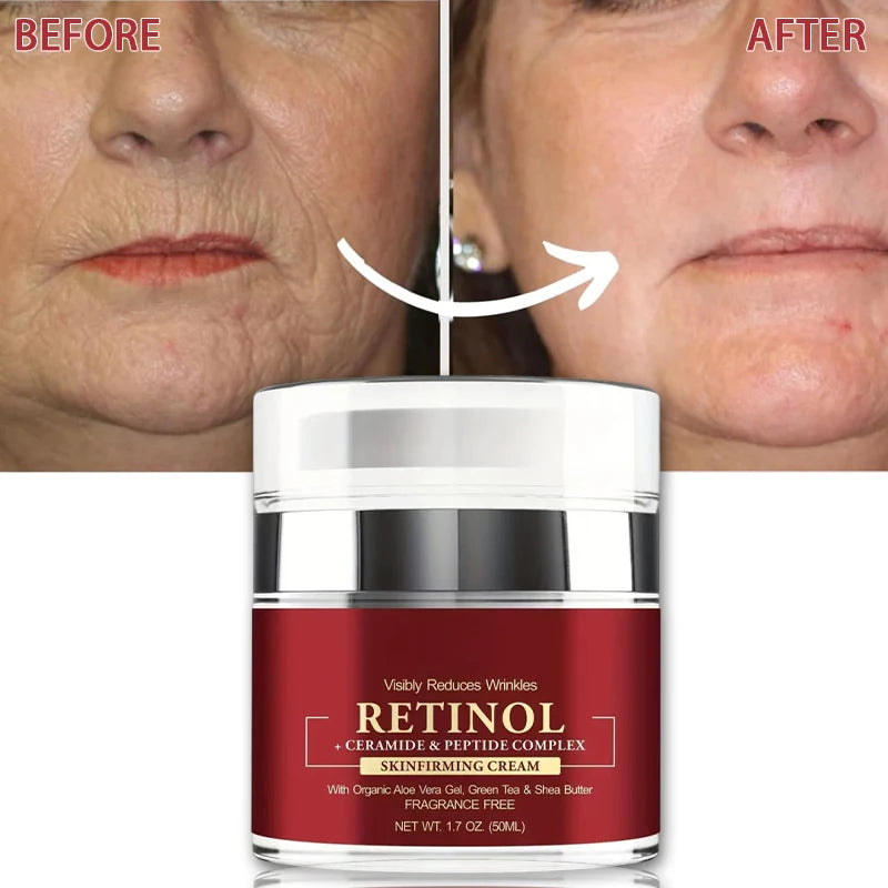 JANYIF Retinol Cream for Wrinkle Reduction and Firming