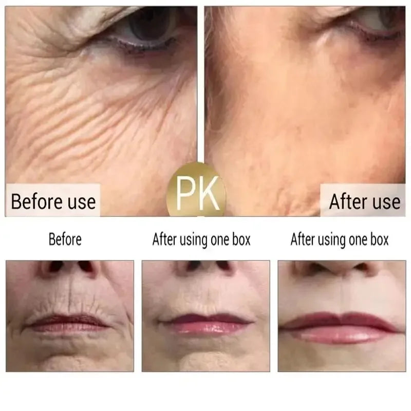 Eelhoe Retinol Wrinkle Remover Face Cream Anti Aging