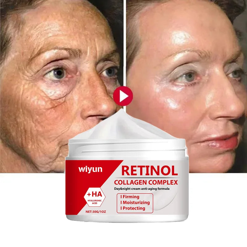 Eelhoe Retinol Wrinkle Remover Face Cream Anti Aging