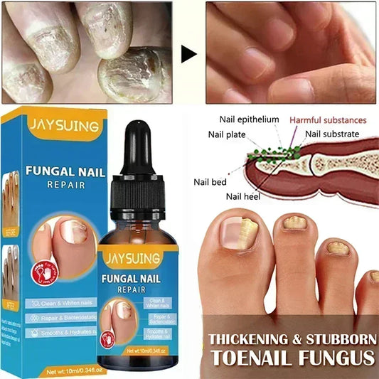 Electric Toenail Fungus Treatment Device Nail Care
