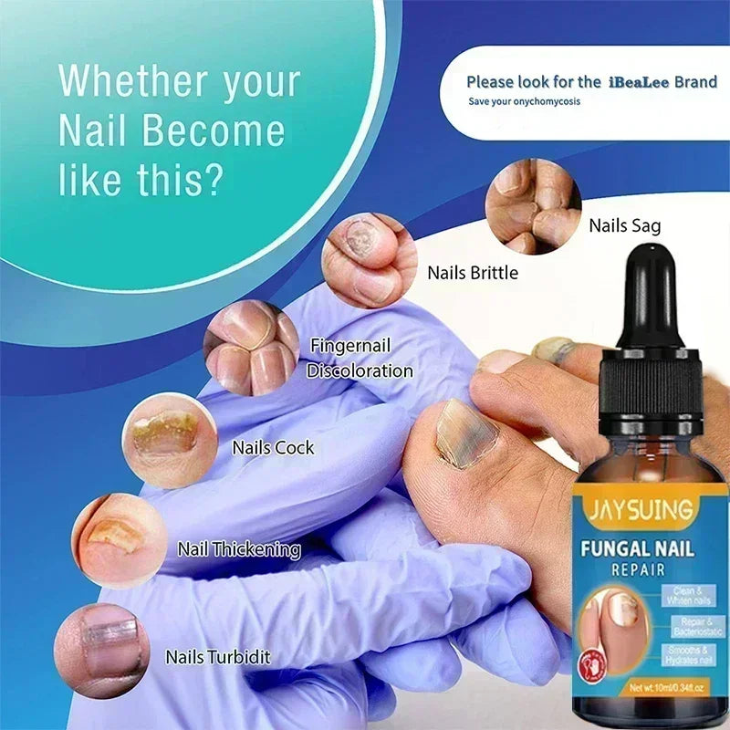 Electric Toenail Fungus Treatment Device Nail Care